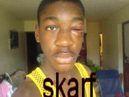 skarf en mode preske mort